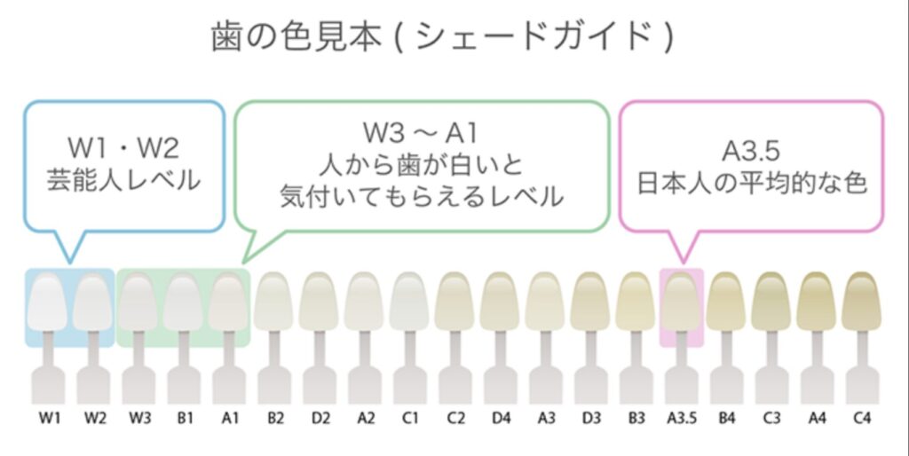 歯の色見本（シェードガイド）。W1・W2が最も白く、A3.5が日本人の平均的な歯の色を示している。